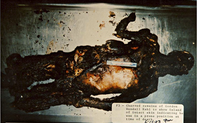 Gordon Kahl's charred and burned remains were reexamined after his exhumation. The island of unburned skin shows that Kahl's body was likely positioned against the floor at the time he was set on fire.